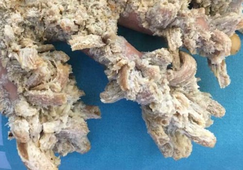 Can humans get sick from tree fungus?
